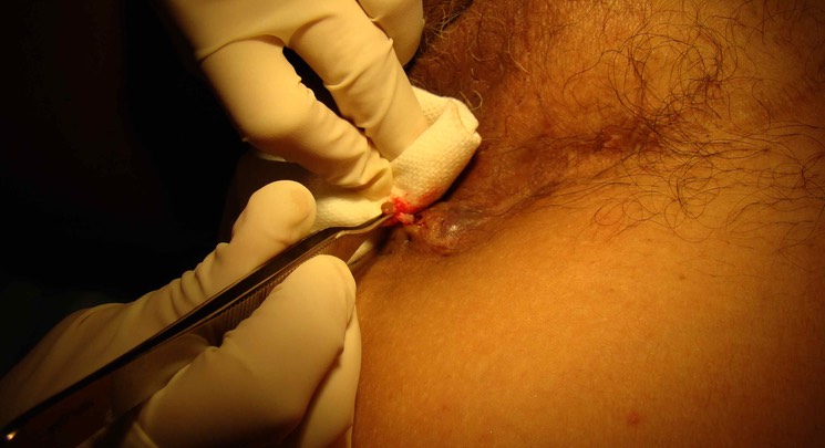 Contenant pour m�dias